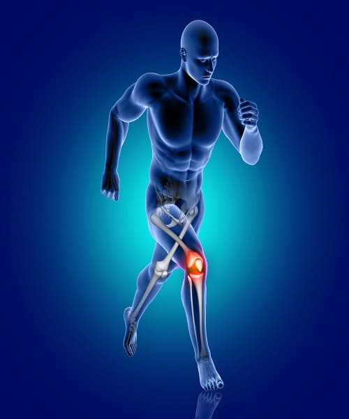 Reparación Meniscal